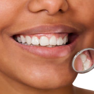 Transform your Smile with Invisalign in Bedford Park, IL